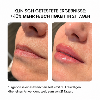 Lippenpflege | HAMINOS®