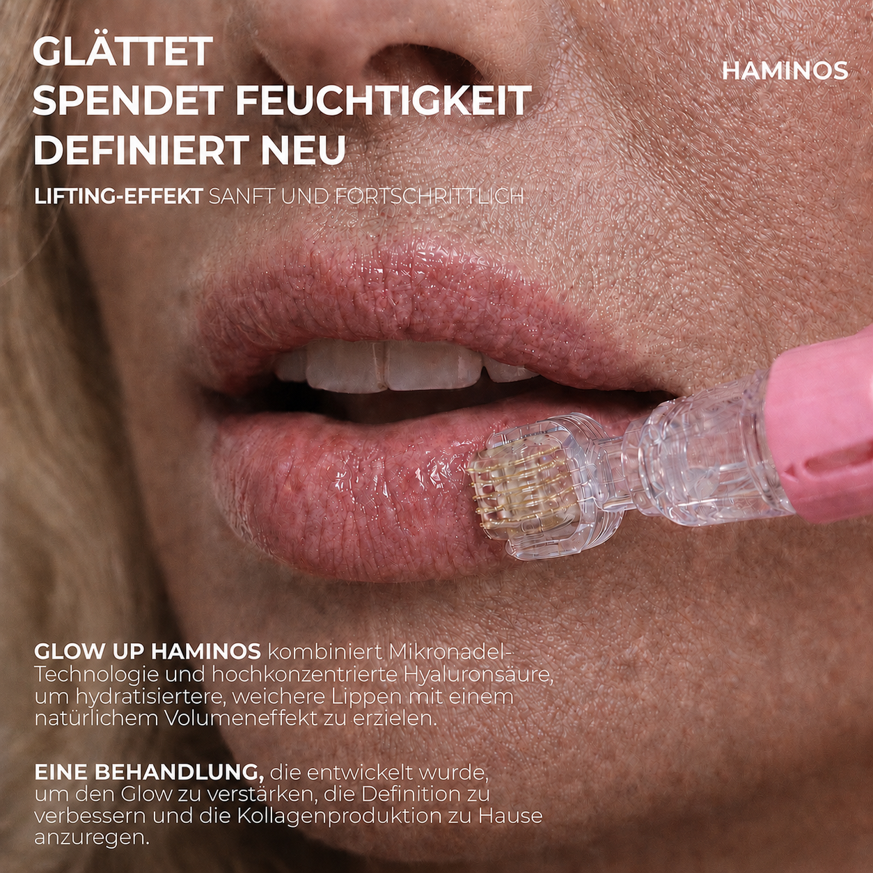 Lippenbehandlung mit Derma roller