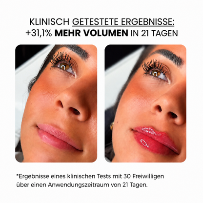 Lippenbehandlung mit Derma roller